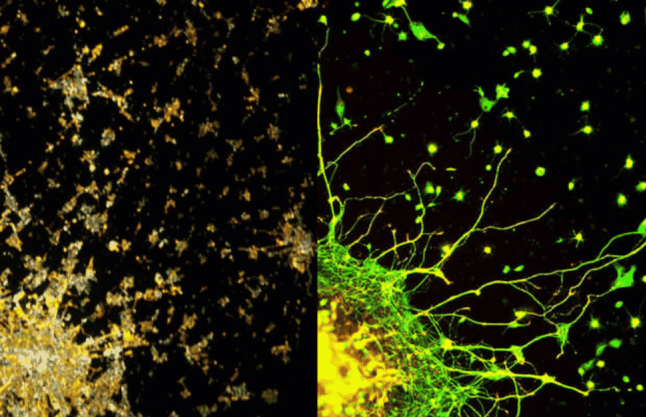 A gauche, une photo de Londres la nuit et à droite, une photo du réseau neuronal du cerveau. Regardez comme cette similitude est frappante.
